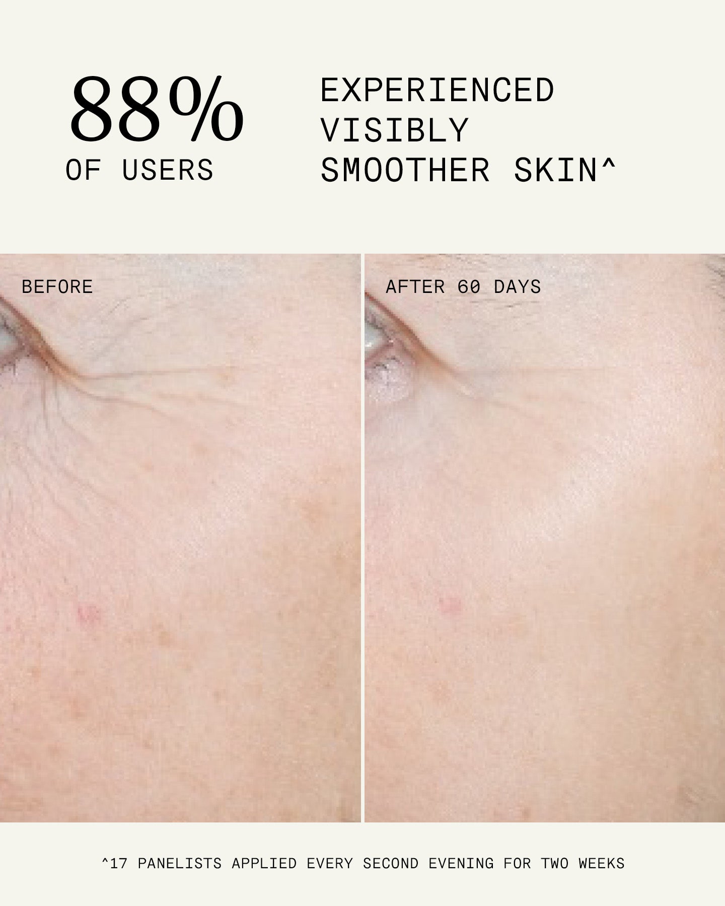 Ultra A Perfecting Serum Mild 30ml