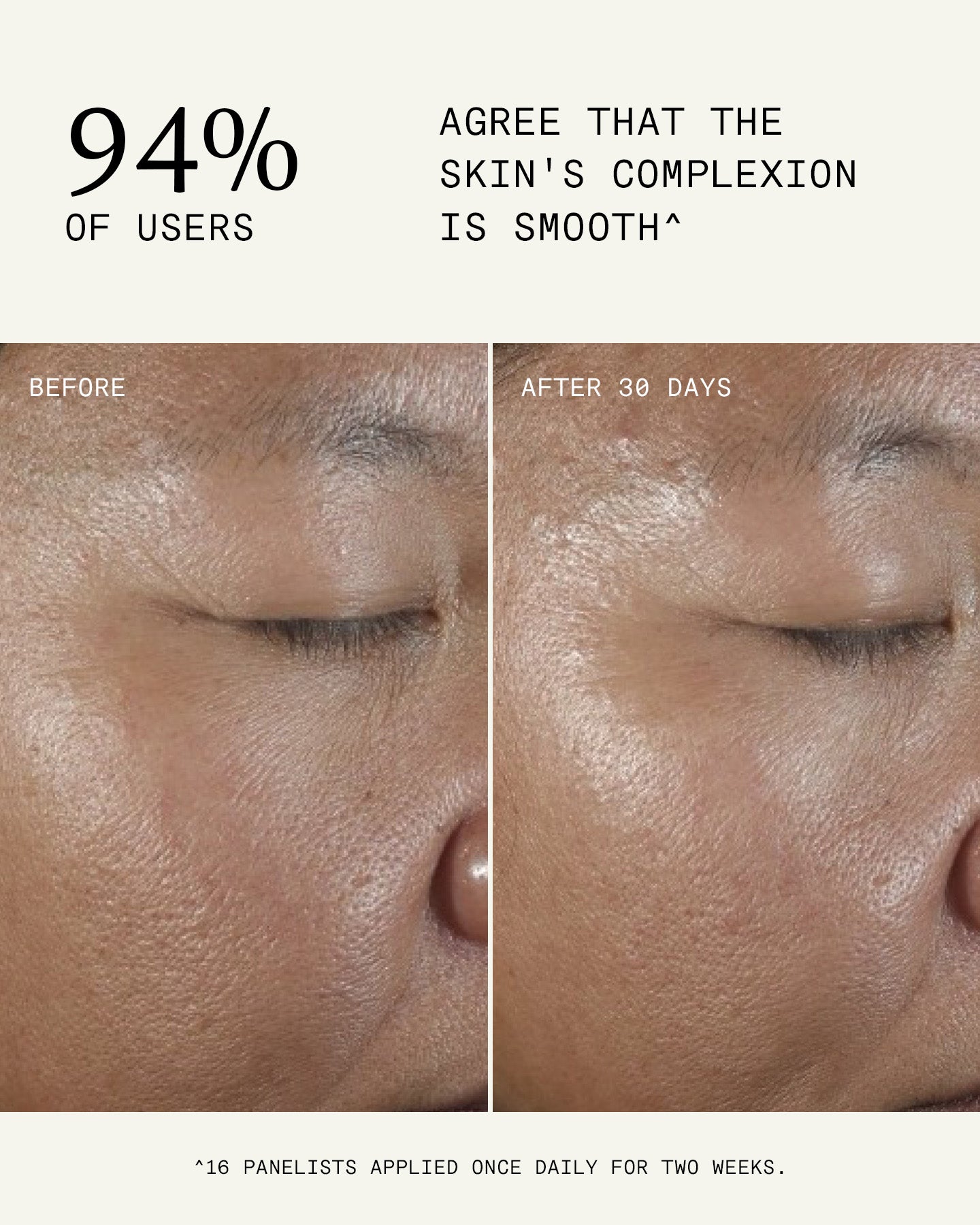 Ultra Resurfacing & Pore Refining Serum 30ml