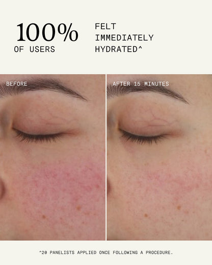 Ultra B2 Recovery Cream 50ml
