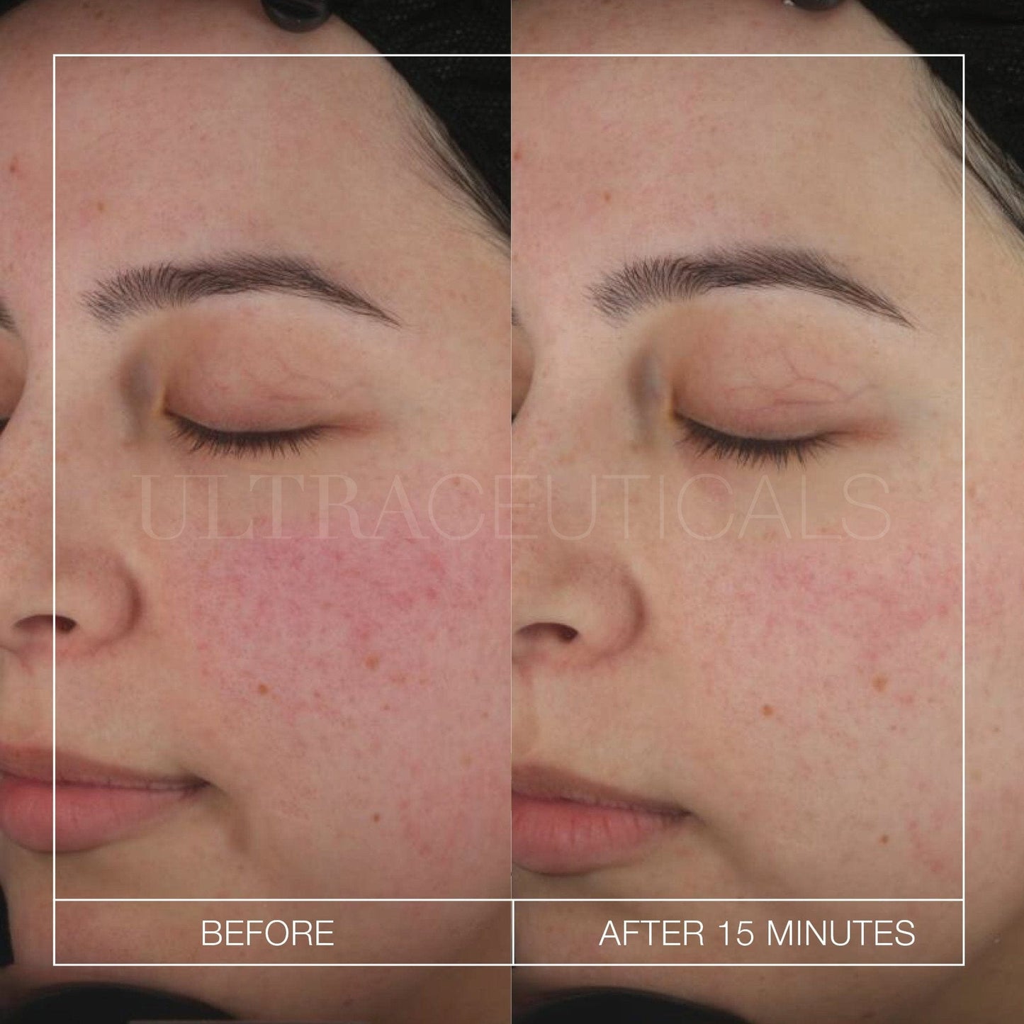 Ultra B2 Recovery Cream 50ml